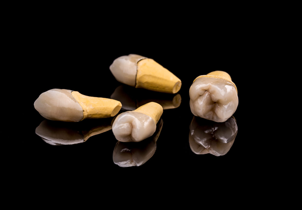 Prosthetic teeth