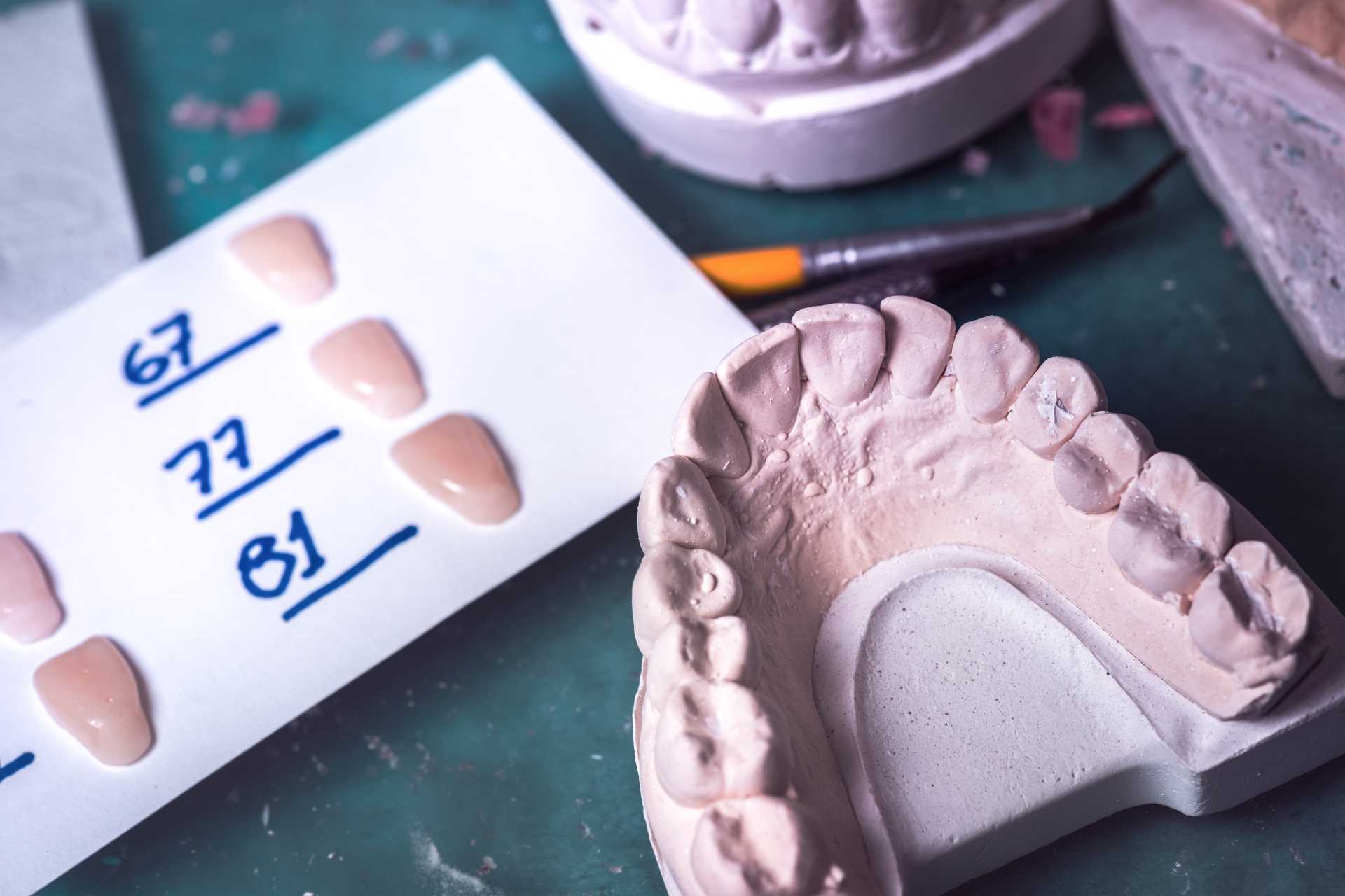 Photo of a set of dentures in the process of being made | Featured image for Denture Health Care’s How Are Dentures Made blog.